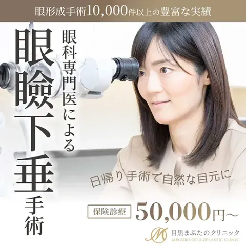 眼科の広告クリエイティブ例