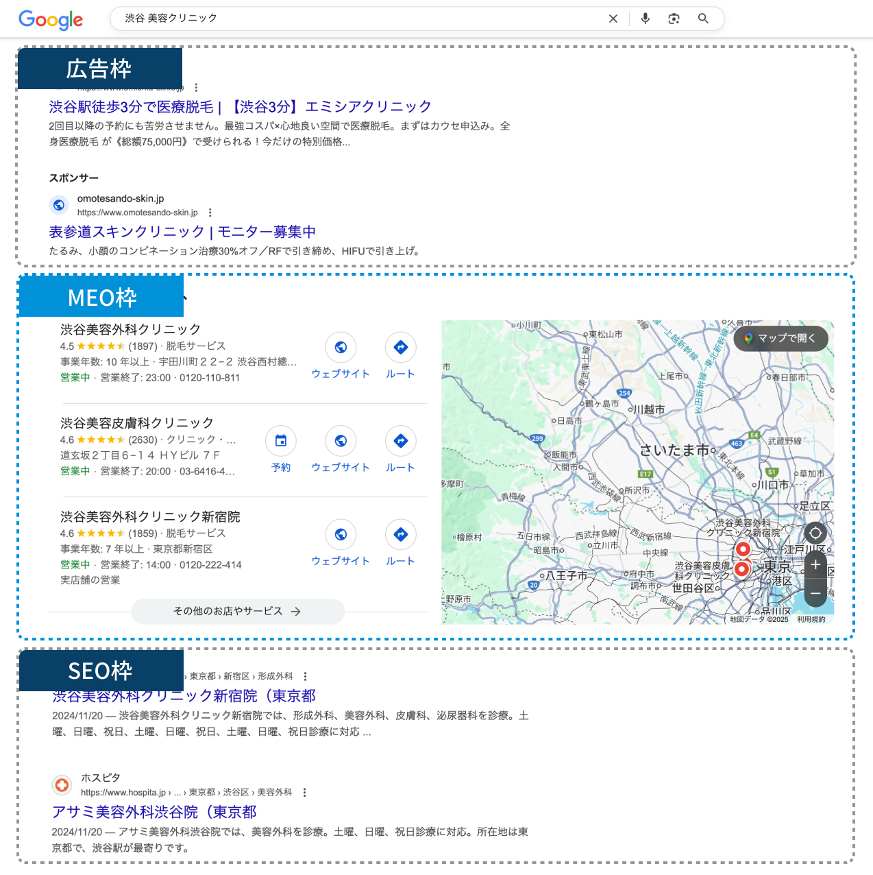 Google検索結果の枠の説明
